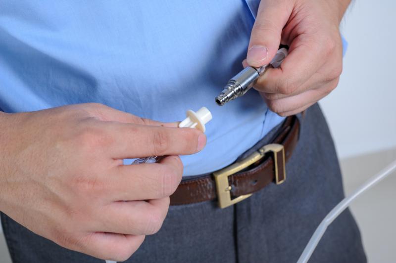 New Review Update Preventing catheterrelated infections in peritoneal